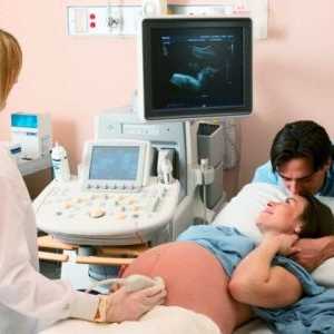 Cum pot determina vârsta gestațională prin ultrasunete. Este sigur la ultrasunete in timpul…