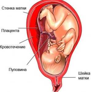 Sangerarea in primul trimestru de sarcină. De ce apar și dacă este normal?