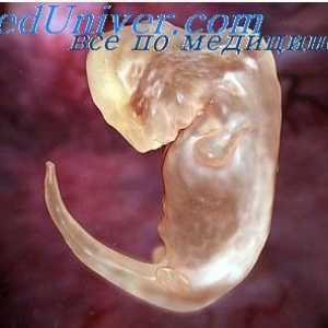 Teoria Stockard. Cauzele anomaliilor de embrion