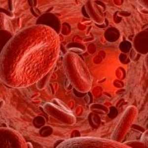 Trombocitopenia: tratament, cauze, simptome, semne