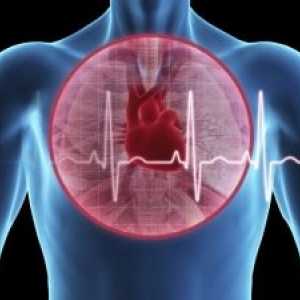 Embolism pulmonar și insuficiență cardiacă acută