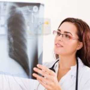 Tuberculoza pulmonară în timpul sarcinii, tratament, simptome, cauze