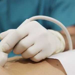 Ultrasonografie (ultrasunete) al cavității abdominale