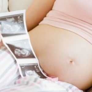 Pelvis îngust în timpul sarcinii