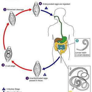 Whipworm patogeni trihotsefaleze, căile de infecție, simptomele și tratamentul bolii la copii și…