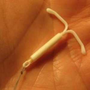 Metodă contraceptivă intrauterină