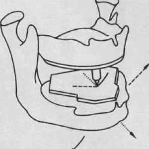 Înregistrare intraorala a mișcărilor mandibulei