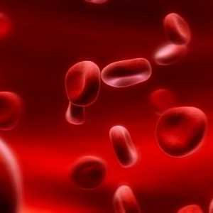 Zhelezorefrakternaya anemie