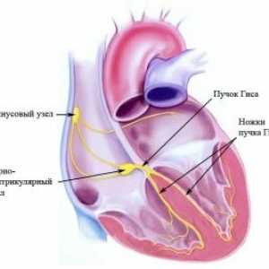 Extrasistole ventriculare: tratament, cauze, simptome, clasificarea